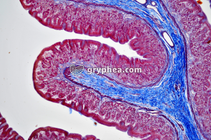 Estomac pylorique x25 - gryphea.org